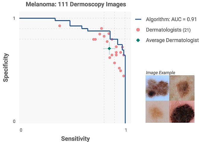 Skin cancer detection with computer vision