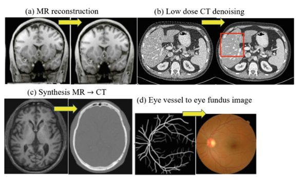 Application of GAN in medical imaging