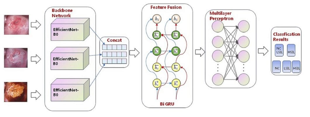 Use case of EfficientNet in cancer detection