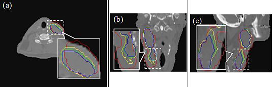 contour based image registration