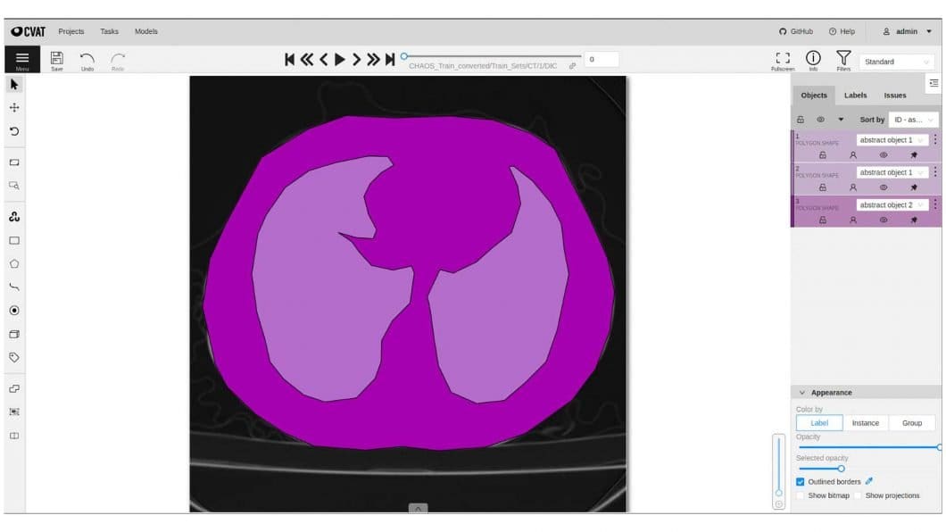 CVAT medical image annotation tool