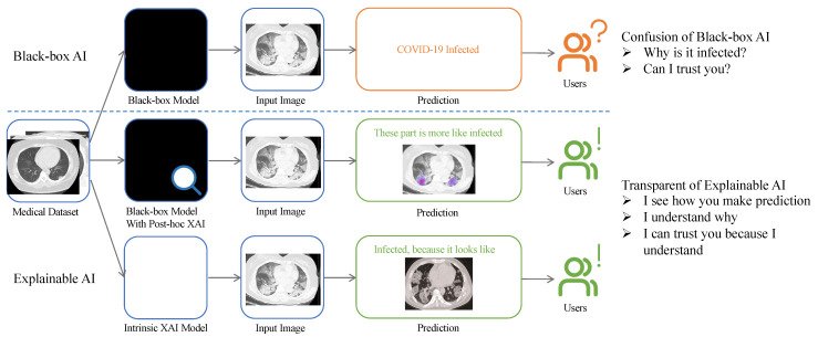 Explainable AI (XAI) Applied in a Healthcare Scenario 