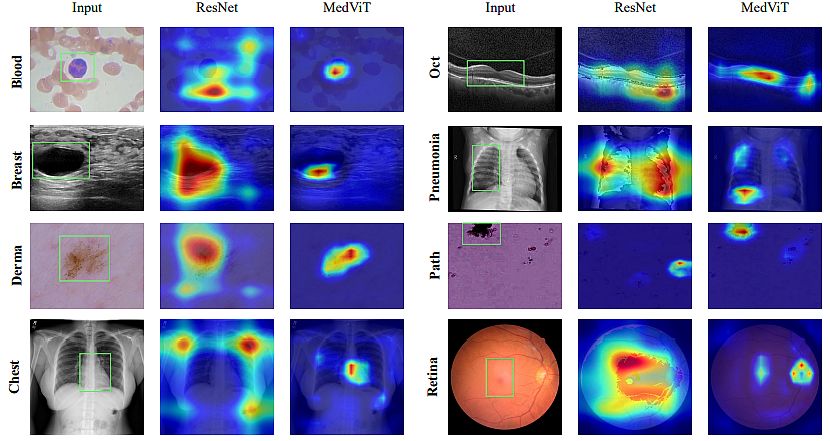 MedViT-ResNet-Classification